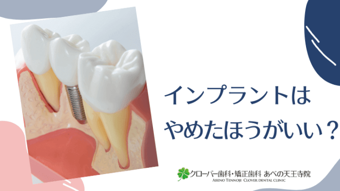 インプラントはやめたほうがいい？｜よくあるご質問 クローバー歯科・矯正歯科あべの天王寺院